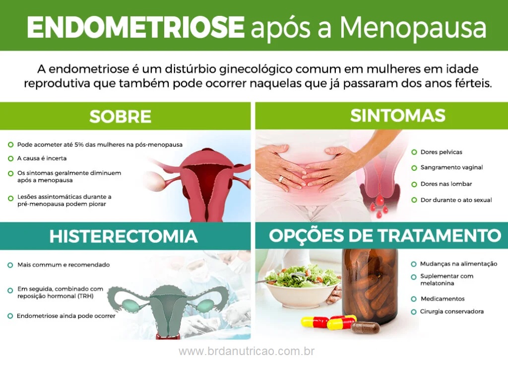 Endometriose na Menopausa: Sintomas, Riscos e Como Tratar 1 endometriose na menopausa