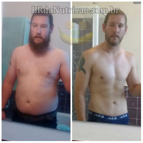 antes e depois gordura no figado