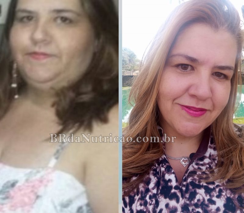 antes e depois sop