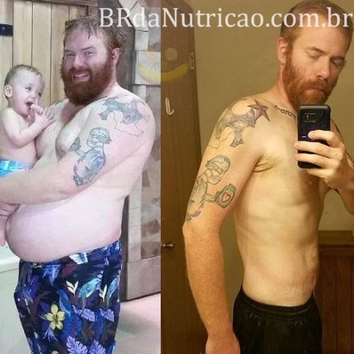 Método Fígado Detox 5 gordura no figado antes e depois