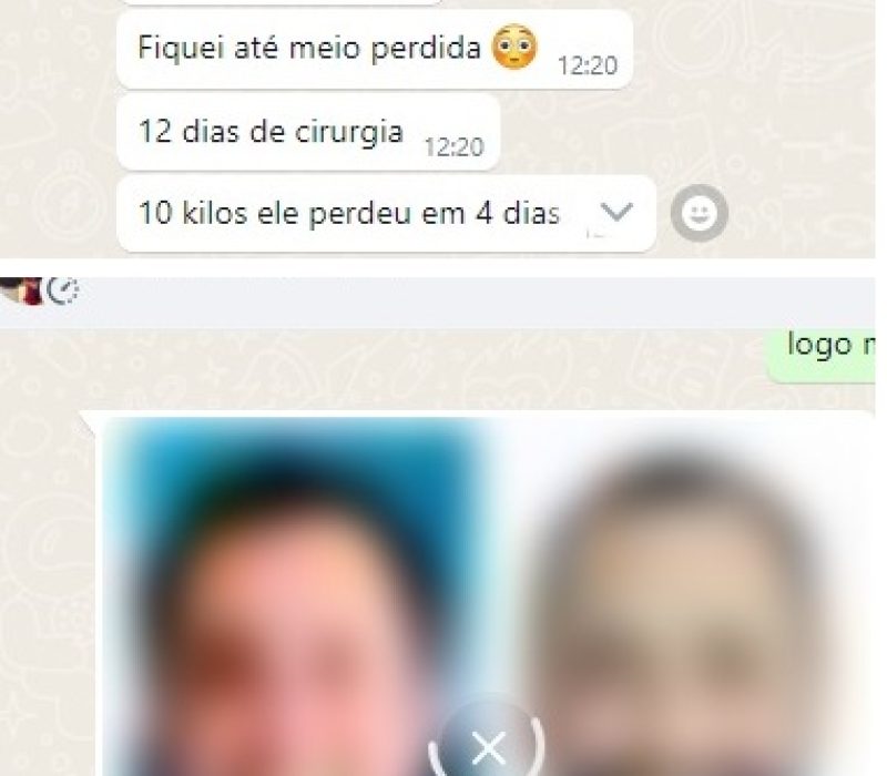 paciente djalma relato para nutricionista bariatrica