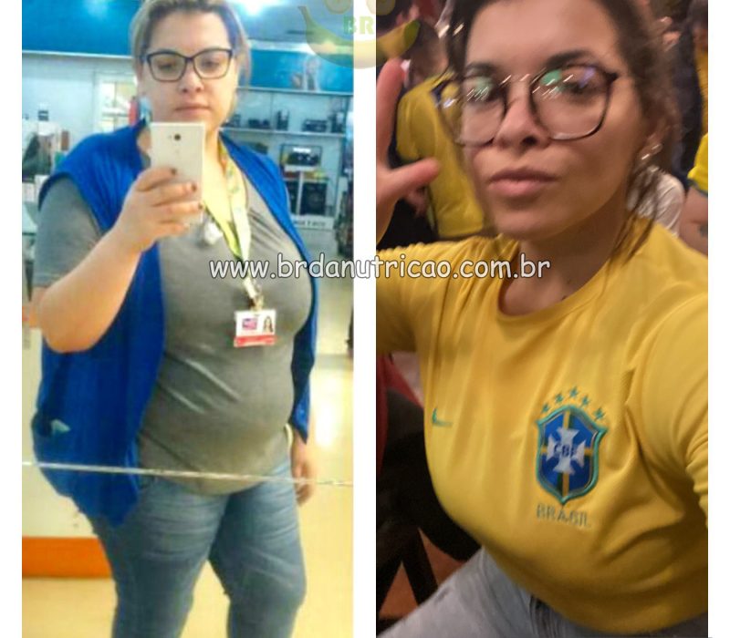 transformação antes e depois carine cirurgia bariatrica